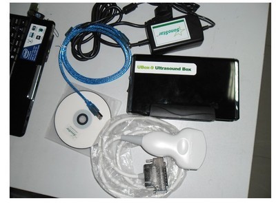 【索諾星UBOX-9門診專用超聲盒B超超聲診斷儀 便攜式黑白三維成像】價格,廠家,圖片,醫療器械制造設備,廣州索諾星信息科技-